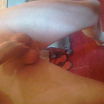 18+