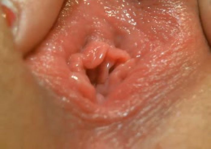 БЛЯТЦКИЙ ПОТРОХ